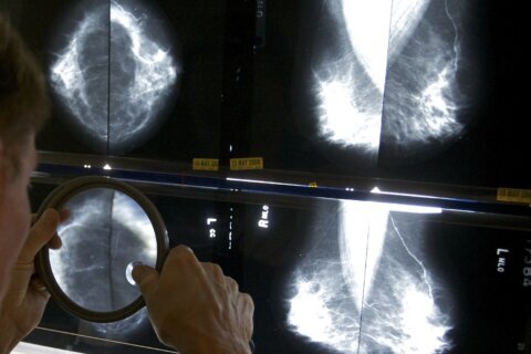 Study: Fewer getting routine cancer screenings despite benefits of early detection